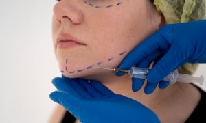 Контурная пластика и филлеры: безопасность и техника введения